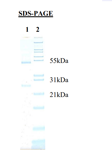 1) IgG<br />2) Mol Weight Standard
